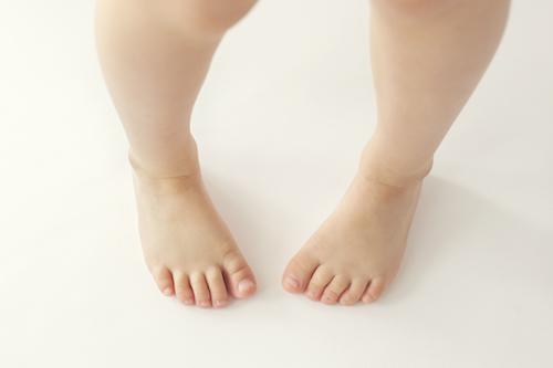 intoeing or being pigeon toed impacting your child's activity