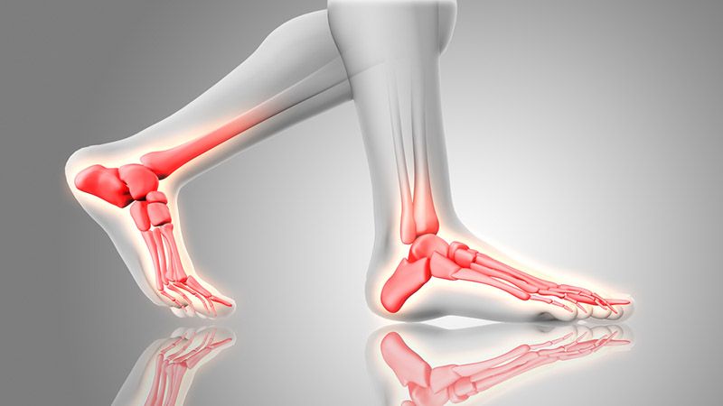 The First Ray – Controlling the Structural Integrity of the Foot