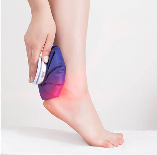 Achilles Tendonitis treatments ice therapy